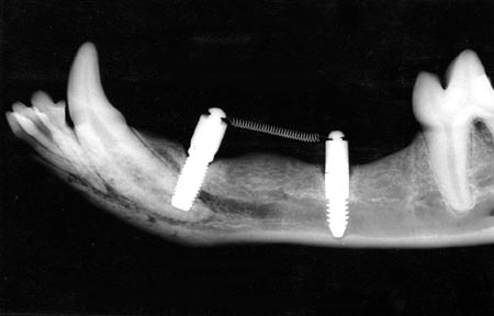 5 ImplantJaw